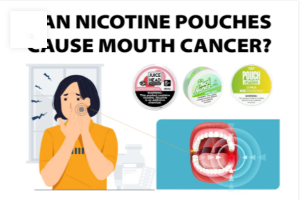 Can Nicotine Pouches Cause Mouth Cancer?