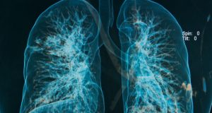 Contrasting Views And Findings About Vaping And Respiratory Health